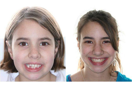 before and after joseph lohner dds ms pa sparta vernon nj